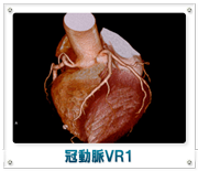 冠動脈VR1