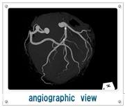 angiographic view