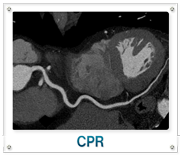CPR