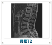 腰椎T2