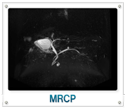 MRCP